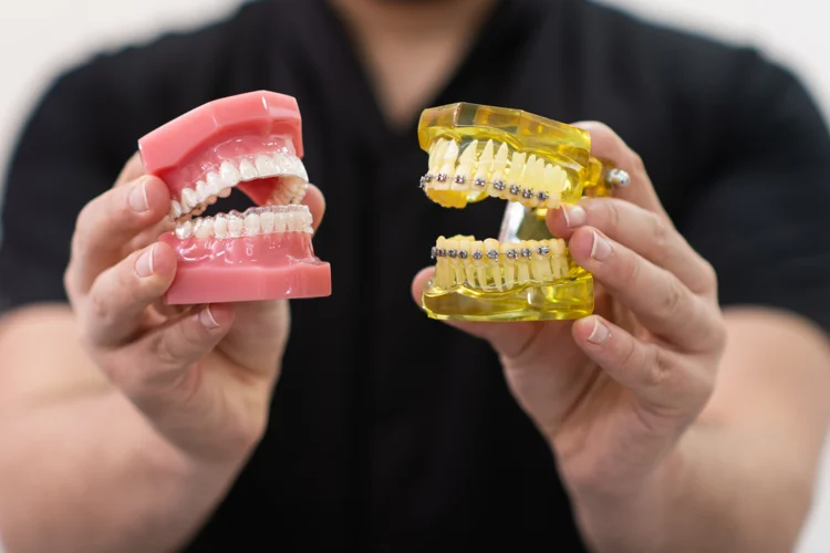 Choosing between Invisalign and braces depends on dental needs, lifestyle, and personal preferences.