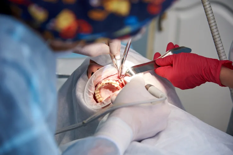 Close-up of a dentist performing sinus lift surgery using specialised tools to lift the maxillary sinus membrane and place bone graft material for dental implant preparation.