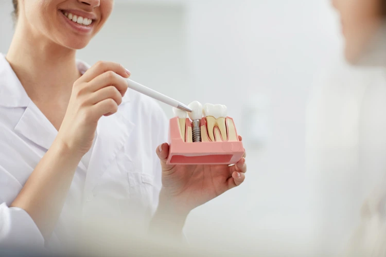 Before and after picture of a female patient's teeth after undergoing teeth whitening procedure.