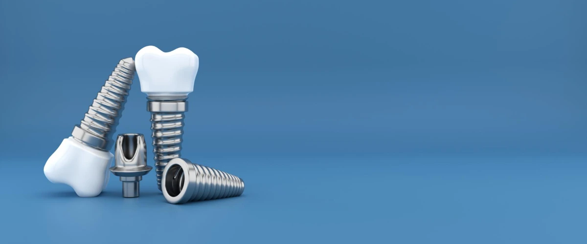 3D rendering of dental implants.