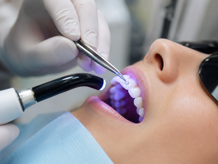 Dentist applying a tooth gem using a curing light in a dental clinic.