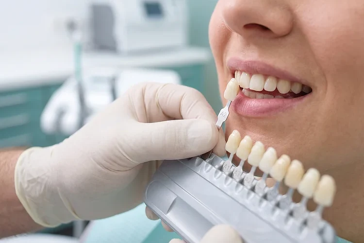 Dentist matching a tooth shade guide against a patient's teeth before teeth bleaching.