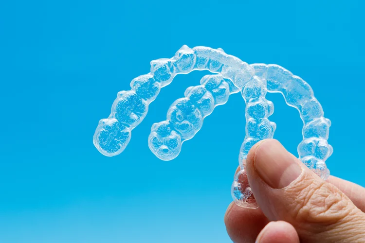 Factors determining the cost of Invisalign include the number of aligners required, customisation, duration of treatment, and any additional treatments needed.