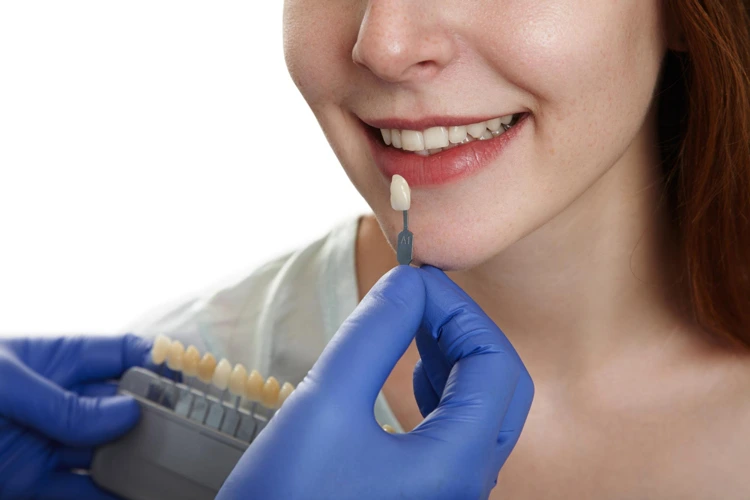 Female patient receiving dental veneers at a dental clinic, benefiting from their realistic appearance, aesthetic appeal, stain resistance, durability, minimally invasive procedure, and quick, effective results.