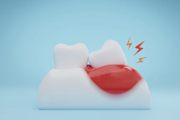 Cross-section of impacted and erupted wisdom teeth showing red gum and pain symptoms in jaw.