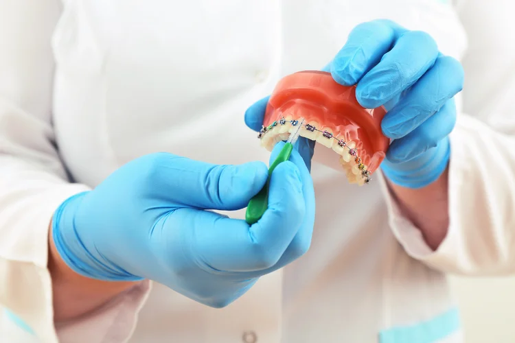Orthodontist holding braces model with interdental brush to demonstrate plaque removal technique.