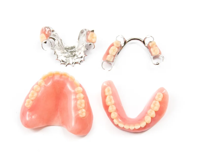 Partial or full dentures replace missing teeth and surrounding tissues, are affordable and non-invasive, but require regular maintenance.