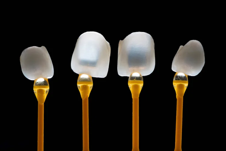 Porcelain veneers, which are ultra-thin, made from durable dental-grade porcelain, and custom-crafted using detailed impressions of a person’s teeth.