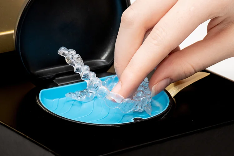 Store Invisalign aligners in the provided case when not wearing them to prevent bacterial contamination, risk of damage, and misplacing them.