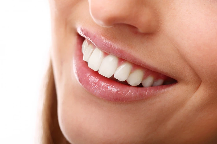 Lady smiling and showing off her beautiful set of white teeth after undergoing teeth whitening procedure.