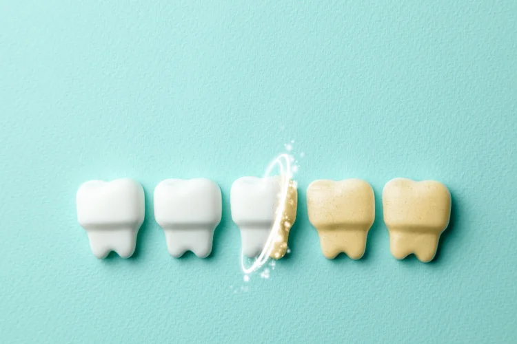 Teeth whitening aftercare is important for maintaining a bright smile and preventing restaining or discolouration.