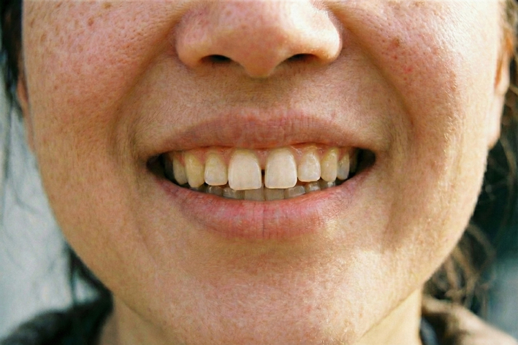 Close-up of woman smiling with a natural gap between her upper front teeth.