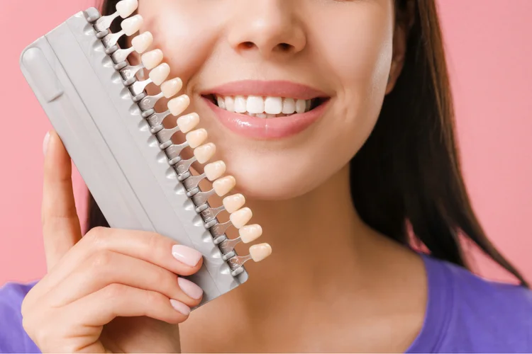 Young Asian woman holding a dental tooth comparator to identify her teeth colour shade as part of the teeth veneer process.