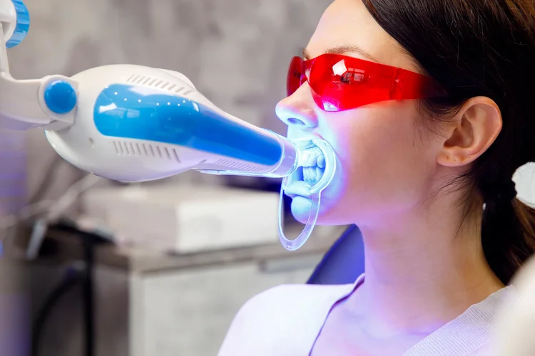 Young Asian woman wearing protective glasses while undergoing professional LED teeth whitening treatment in a dental clinic.